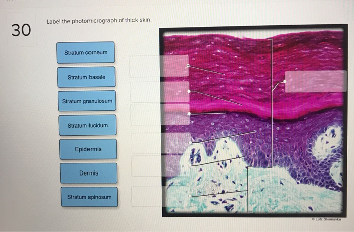 Label the photomicrograph of thick skin