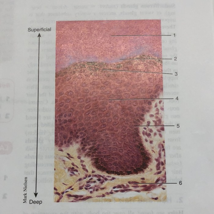 Label the photomicrograph of thick skin