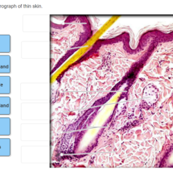 Label photomicrograph thick skin tissue connective physiology 2115 anatomy sc