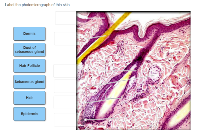 Label photomicrograph thick skin tissue connective physiology 2115 anatomy sc