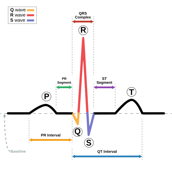 Conduction system of the heart and electrocardiography exercise 31