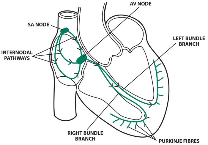 Conduction system of the heart and electrocardiography exercise 31