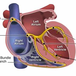 Conduction system of the heart and electrocardiography exercise 31